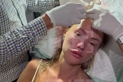 Россиянка оглохла после удара бутылкой по голове на Бали Россиянка оглохла после удара бутылкой по голове на Бали